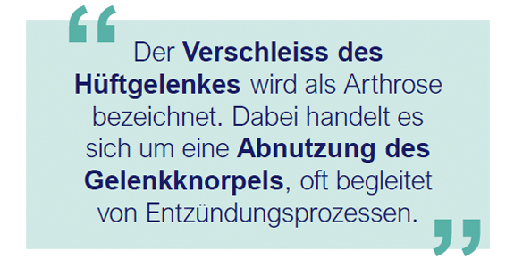 Articon.ch Arthrose des Hüftgelenkes (Coxarthrose)