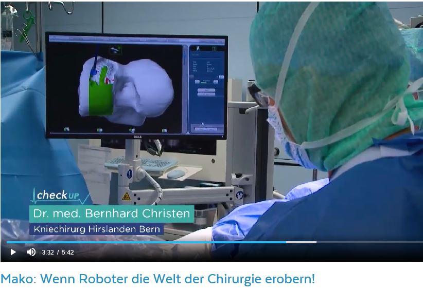 Articon.ch MAKO Roboterarm-assistierte Knieprothetik, ein Fernsehbeitrag