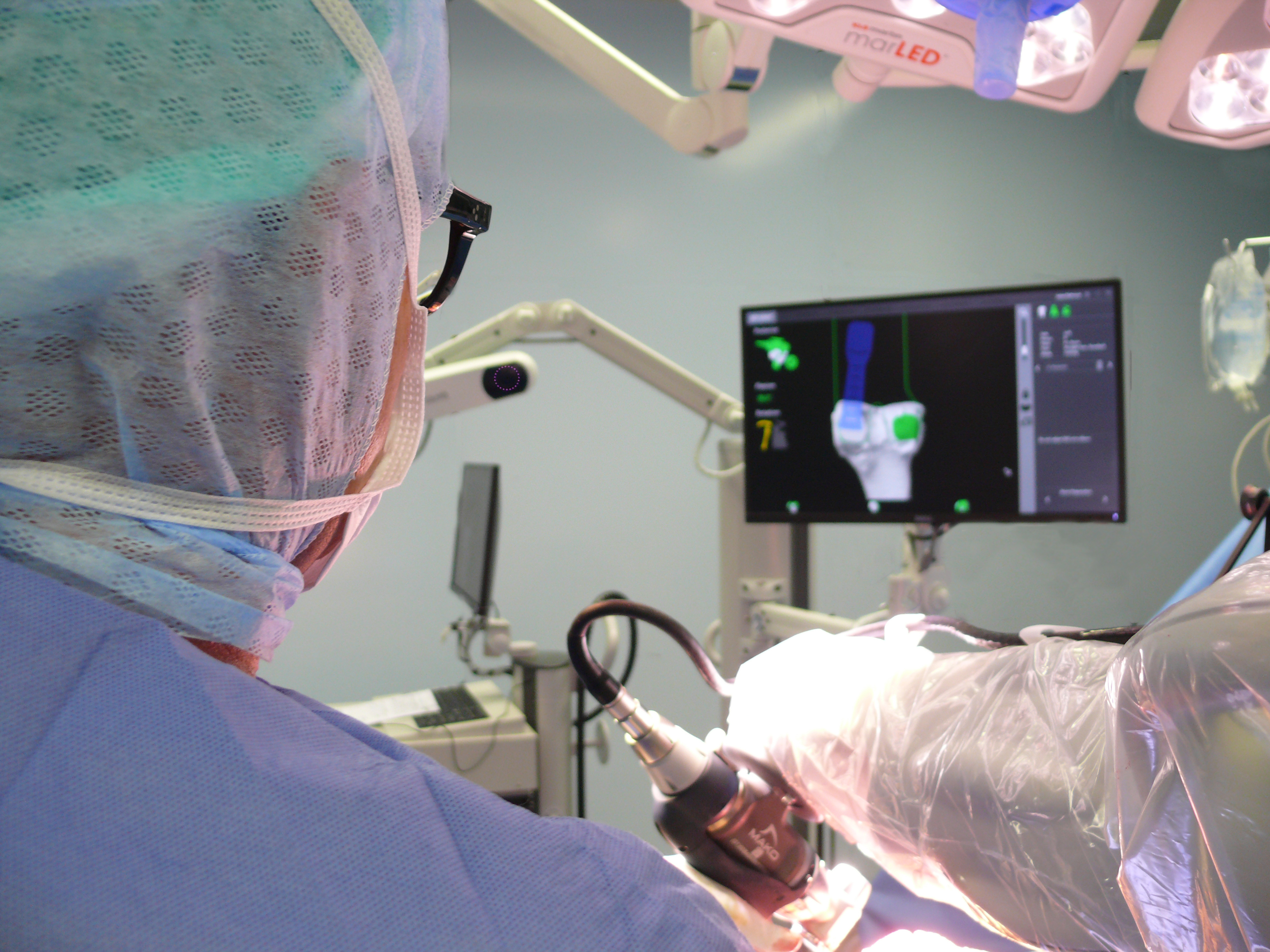 Der Chirurg hat alle Informationen in Echtzeit auf dem Bildschirm und kann in der Operation Anpassungen vornehmen.